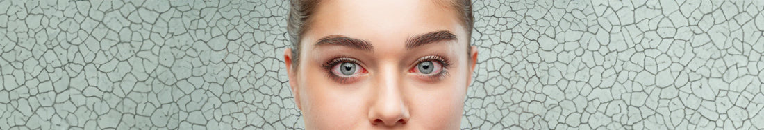 Contact Lenses for Dry Eyes